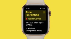 Apple Watch's Innovative AFib Detection Tool Receives FDA Approval