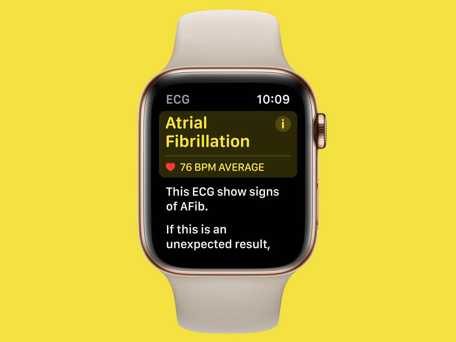 Apple Watch's Innovative AFib Detection Tool Receives FDA Approval